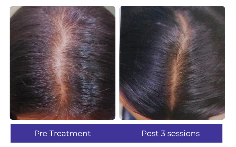 Hair result — visible improvement