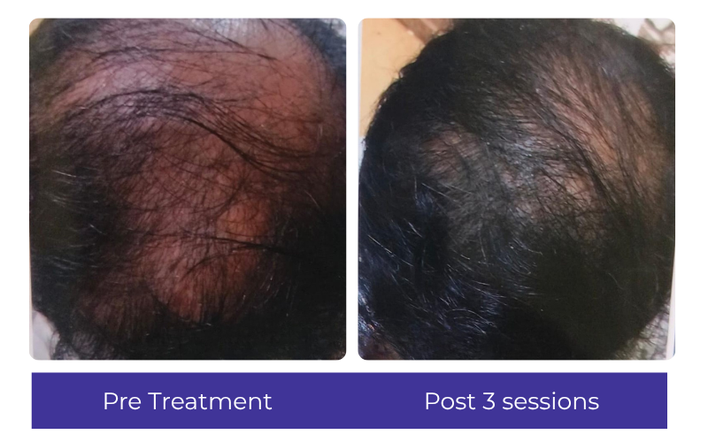 Hair result — visible improvement