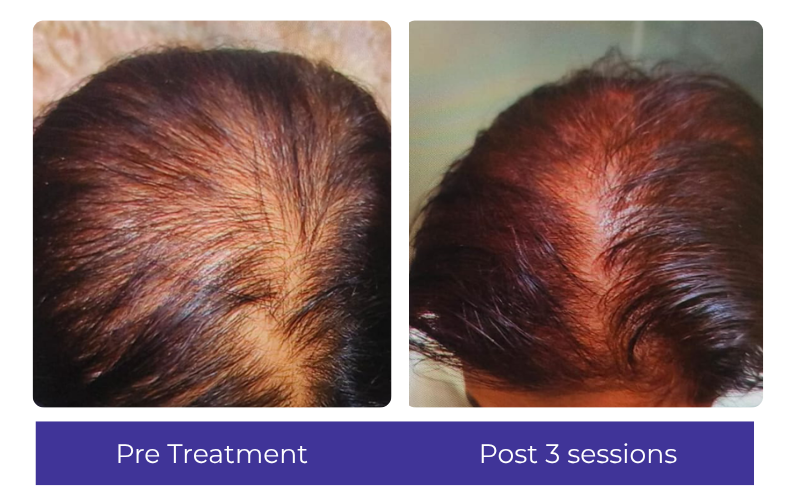 Hair result — visible improvement