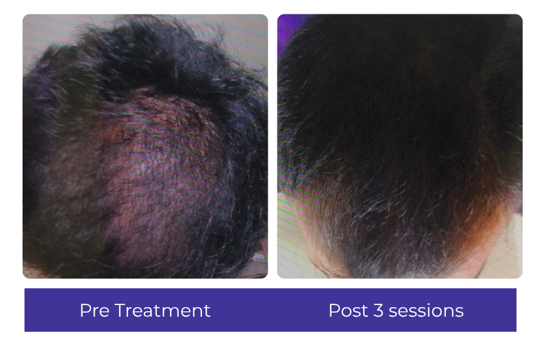Hair result — visible improvement