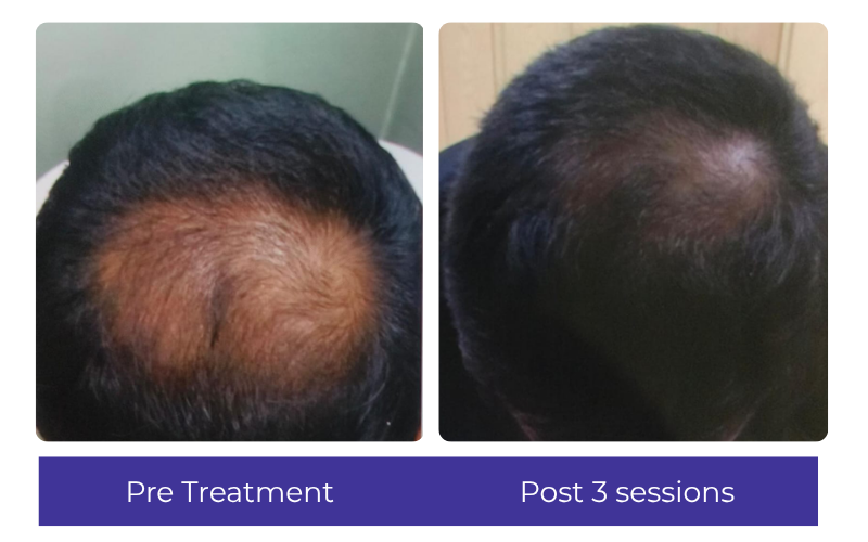 Hair result — visible improvement