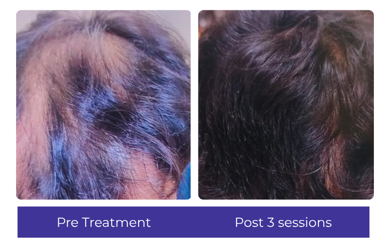 Hair result — visible improvement