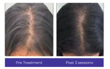 Before-After-2