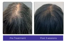 Before-After-3