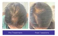 Before-After-4