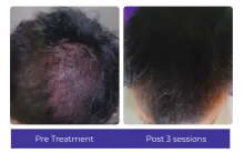 Before-After-7