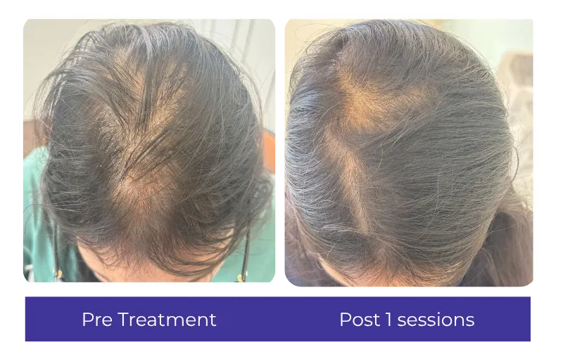 Before-After-4