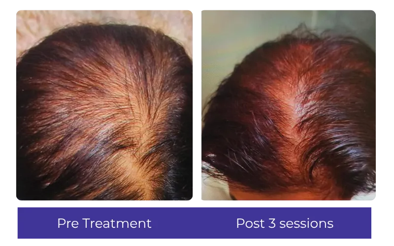 Before-After-6