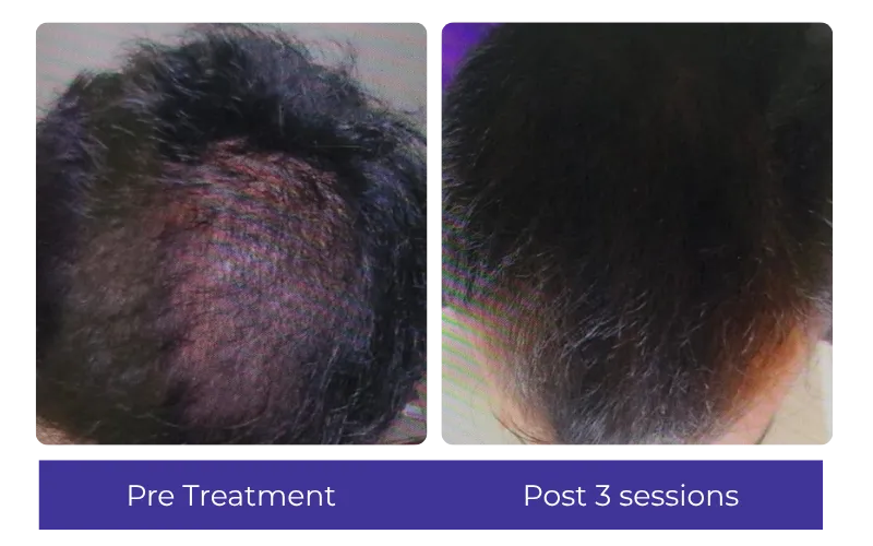 Before-After-7