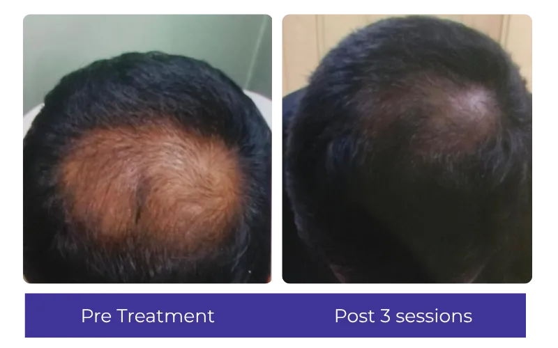 Before-After-8