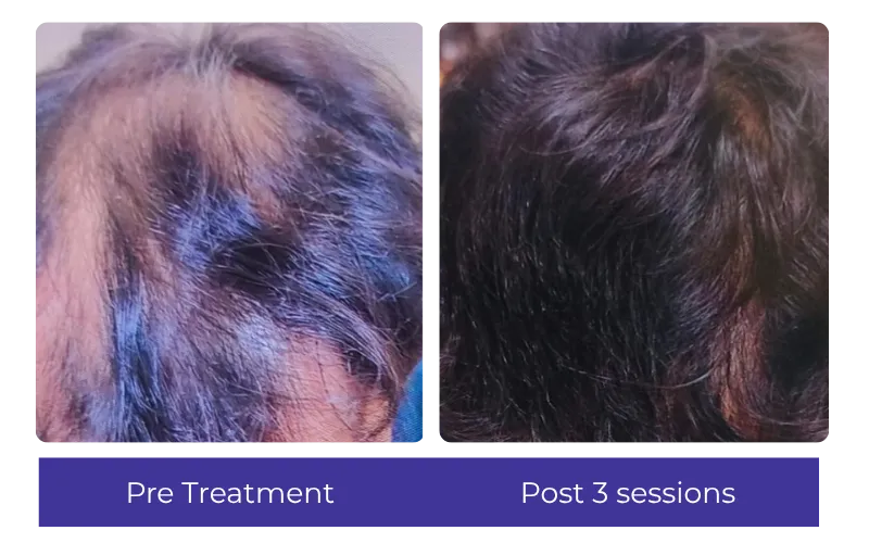 Before-After-9